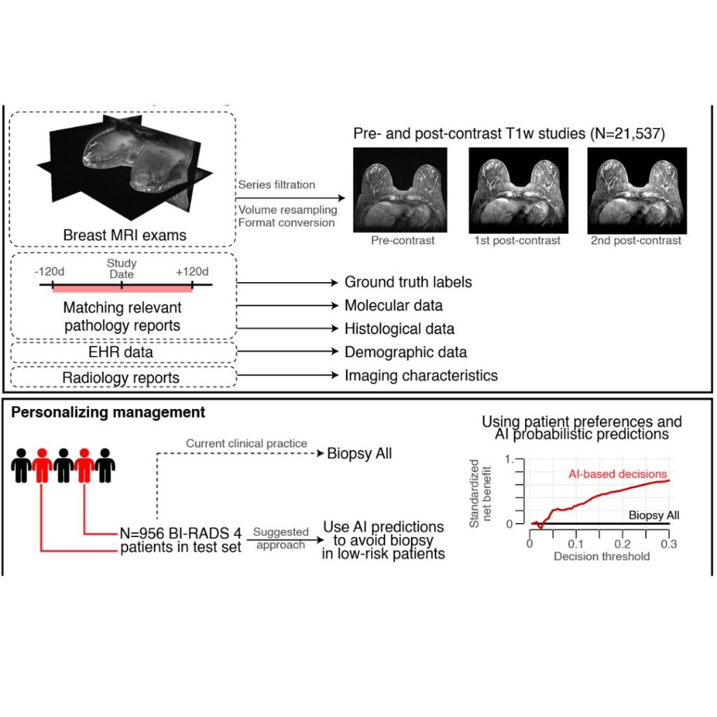 Overview of the study that trains and evaluates an AI system based on deep neural networks to predict the probability of breast cancer in DCE-MRI studies